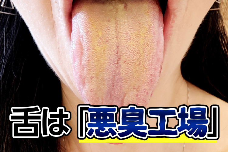 舌は悪臭工場