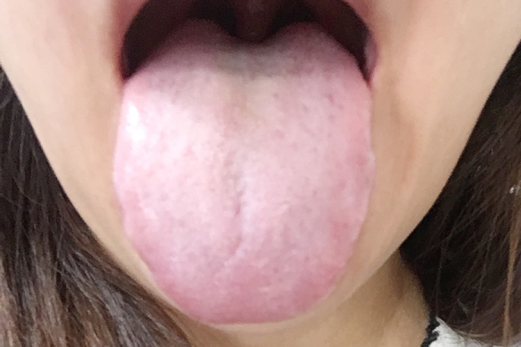 キレイな舌の画像