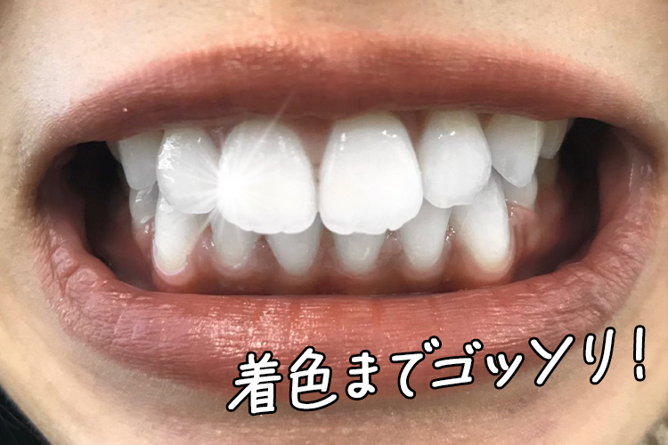 着色までゴッソリ！