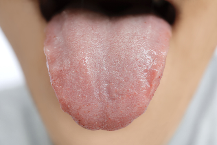 きれいな舌の画像